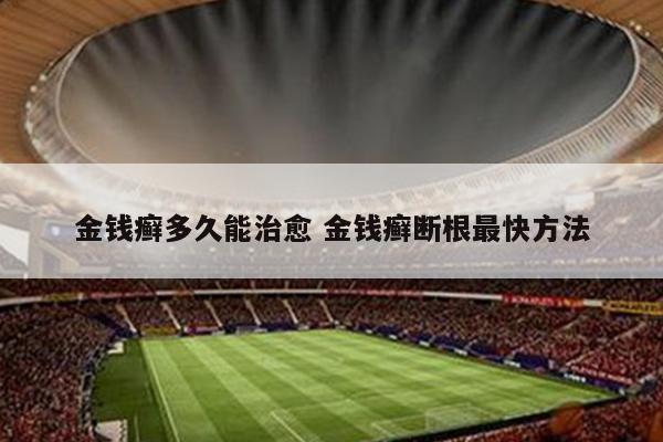 金钱癣多久能治愈 金钱癣断根最快方法